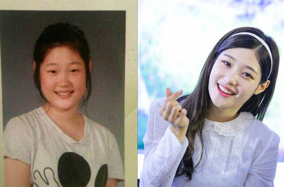 “Tôi không thẩm mỹ mắt mà chỉ làm mũi thôi”, Jung Chaeyeon nói. Nữ ca sĩ nhóm DIA/I.O.I cũng là một trong những sao Hàn công khai  phẫu thuật thẩm mỹ.